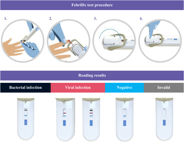 Lumos “ FebriDx” ātrais vīrusu un baktēriju diferenciācijas eksprestests 1gb